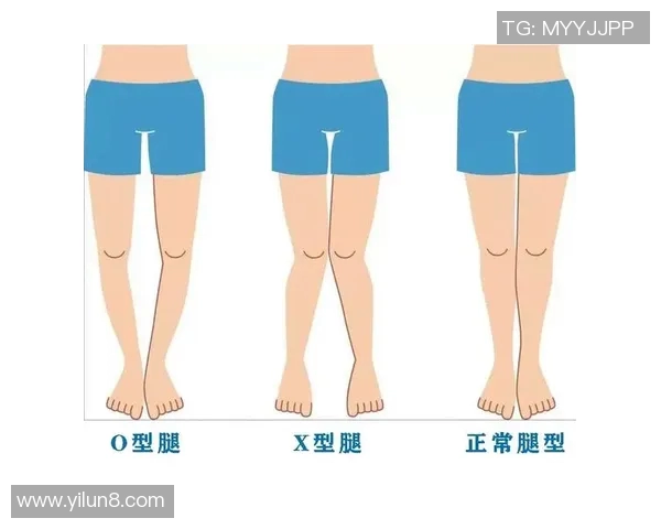 为什么许多足球明星都有O型腿现象背后的原因与科学解释